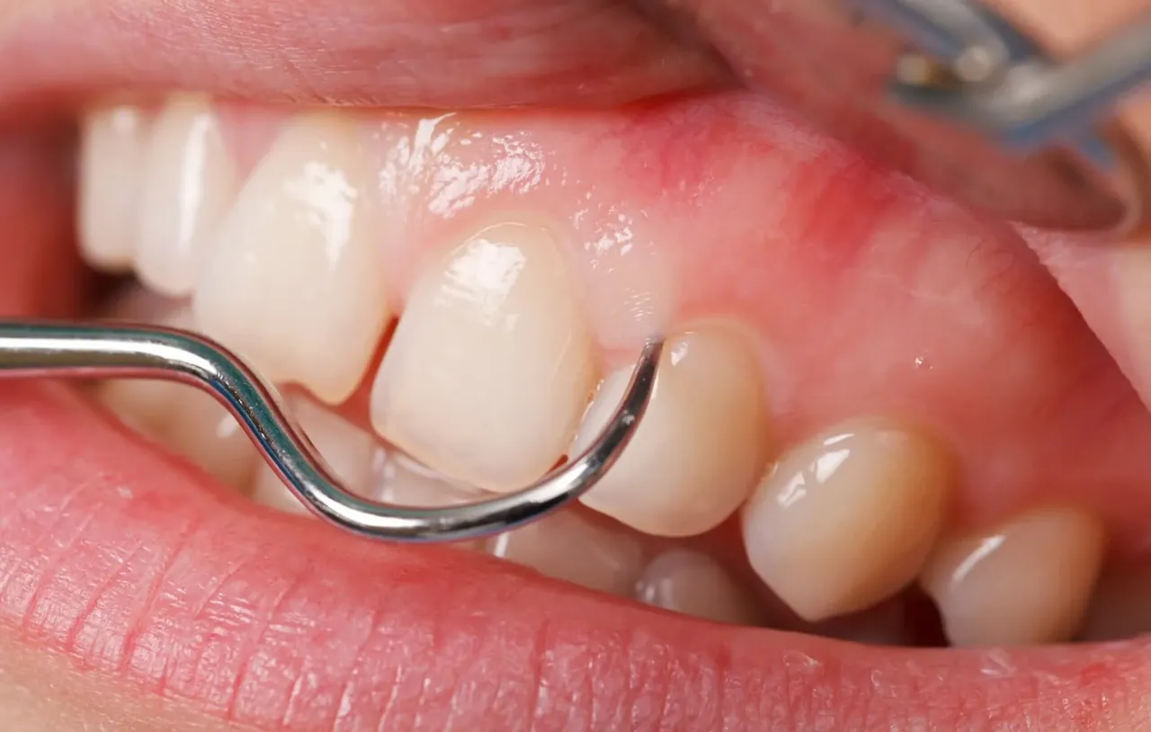 100+ ảnh phụ liệu tóc chuyên nghiệp, ấn tượng
